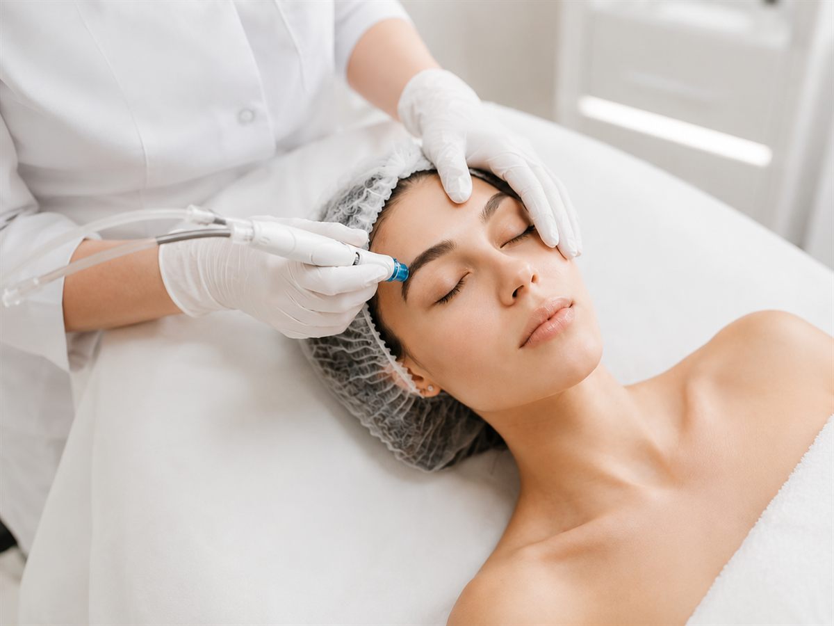 Kolagénová indukčná terapia — ošetrenie pleti